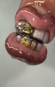 Glossy 3D nail art with pink lips, gold and silver tooth designs